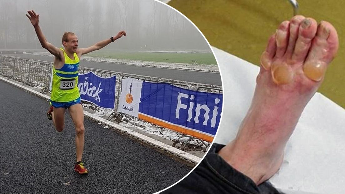 Erwin Harmes kan even niet lopen door aanvaring met pan spaghetti