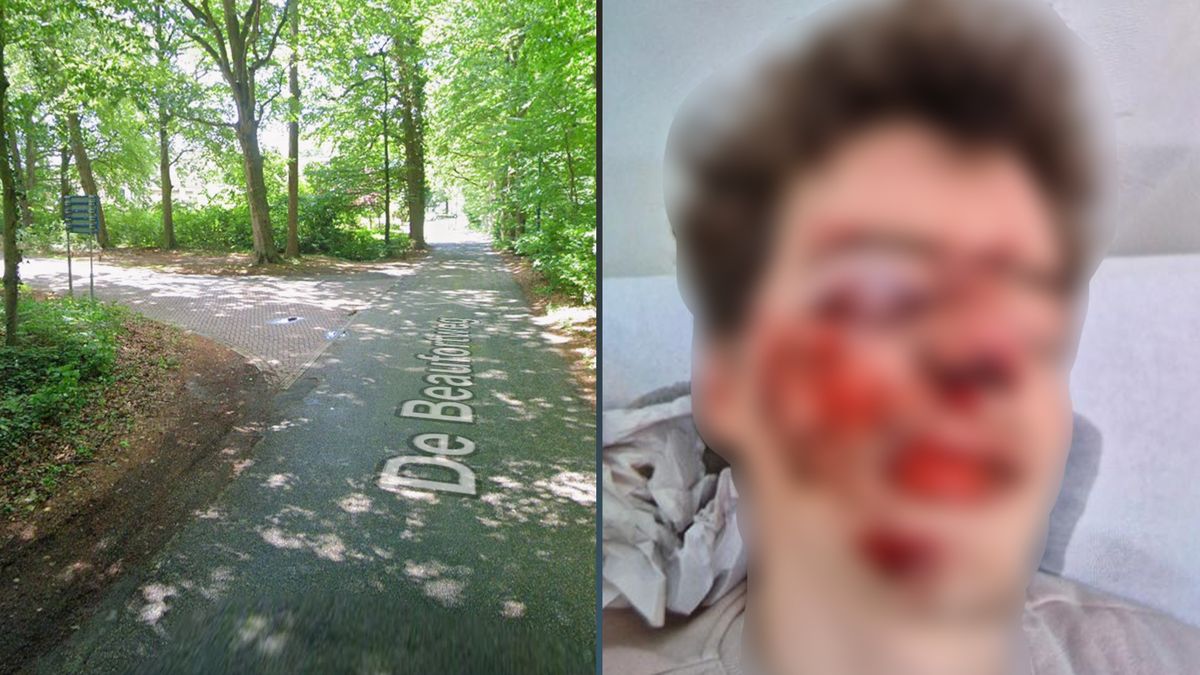 20-jarige jongen ernstig mishandeld in Doorn