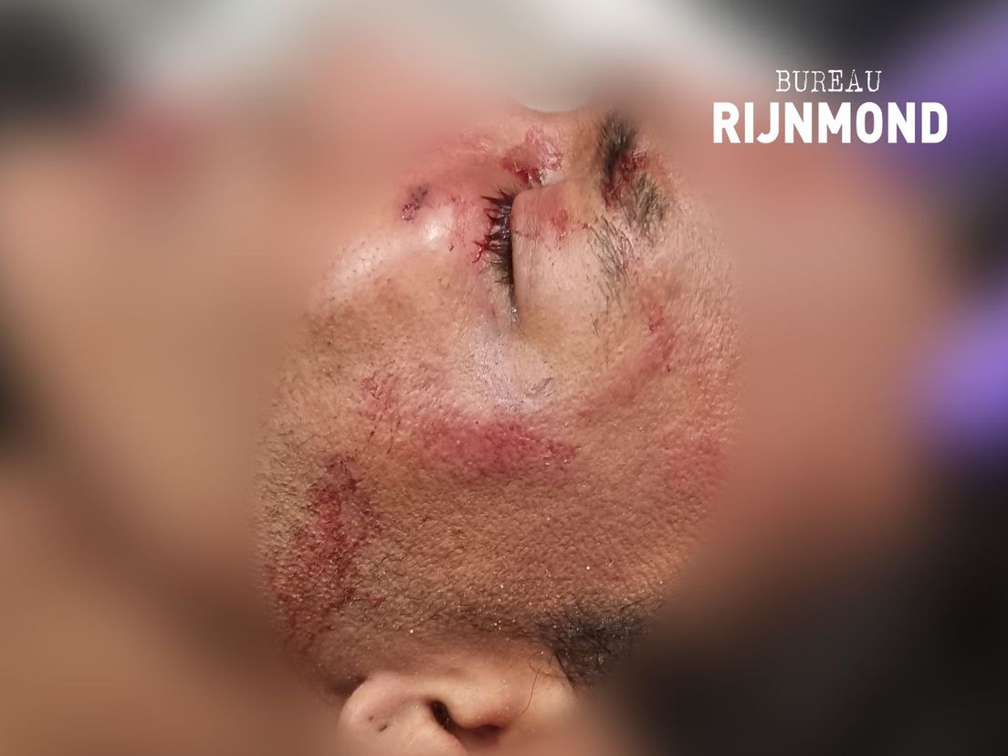 Cameratoezicht ontdekt mishandeling in Kruiskadehof