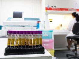 UMC Utrecht: derde Europeaan officieel genezen van hiv door stamceltransplantatie