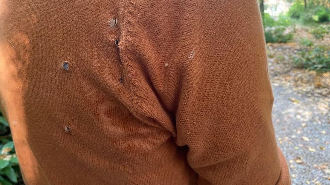 De trui van de campingbewoner die door vonken geraakt werd, is flink gehavend.