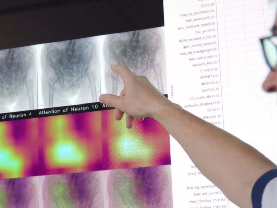 Regionale samenwerking ziekenhuizen verbetert diagnoses na scans, röntgen, CT en MRI