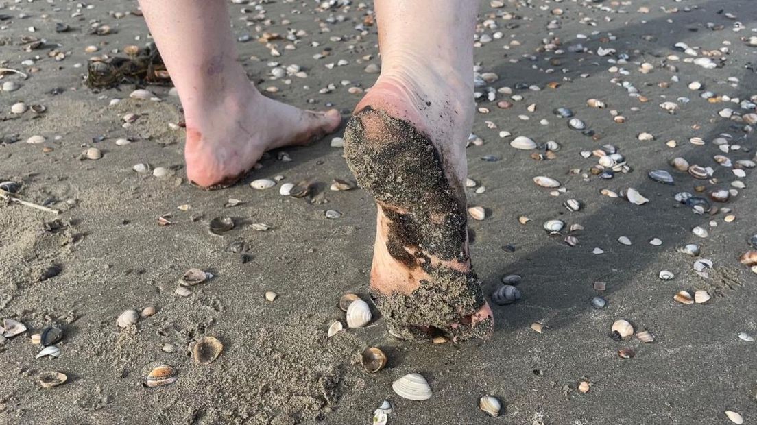 Zwarte voeten van de stookolie op Scheveningen