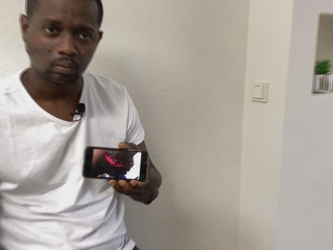 Ludsley laat zien hoe hij eraan toe was toen hij toegetakeld was door de Dordtenaar